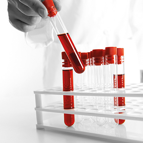blood test to test the viscosity of the blood blood test to test the viscosity of the blood